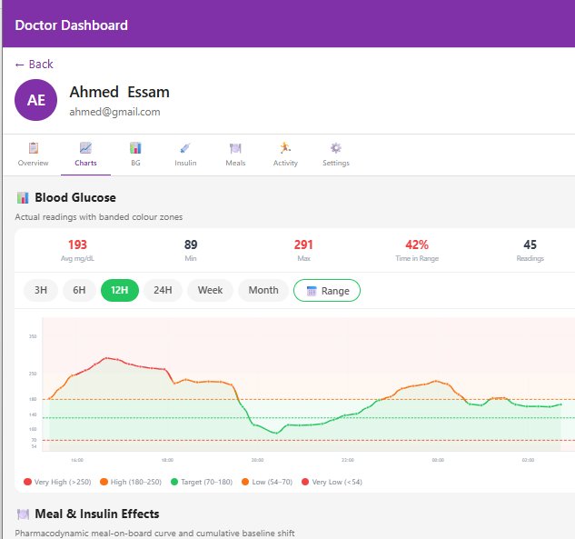 DiaTwin — CGM dashboard and IOB graph